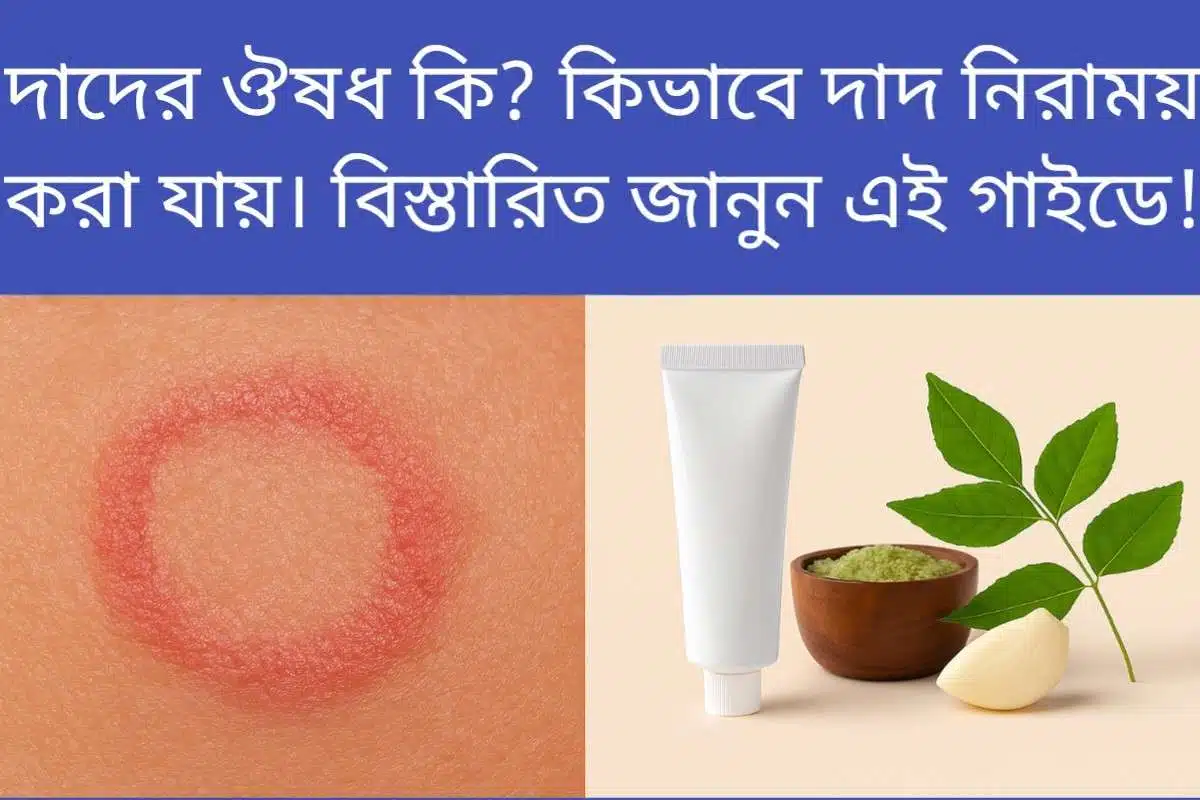 দাদের ঔষধ কি এবং ঘরোয়া পদ্ধতিতে দাদ সারানোর কার্যকর উপায়