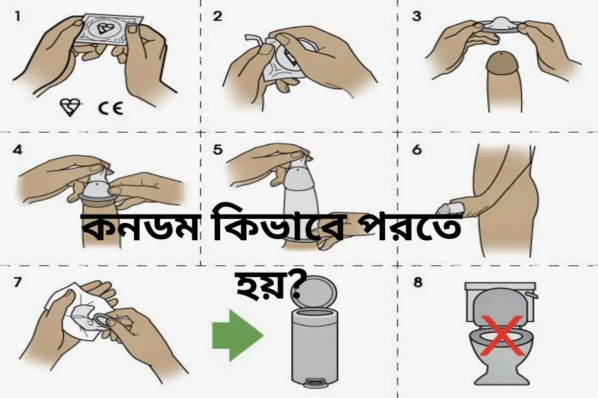 একটি হাতের তালুতে ধরা একটি সিল করা কনডমের প্যাকেট, যা কনডম কিভাবে পরতে হয় বিষয়ক একটি ব্লগের প্রধান চিত্র হিসেবে ব্যবহৃত হচ্ছে। পেছনের আবছা যুগলটি নিরাপদ এবং সচেতন যৌন আচরণের প্রতীক।