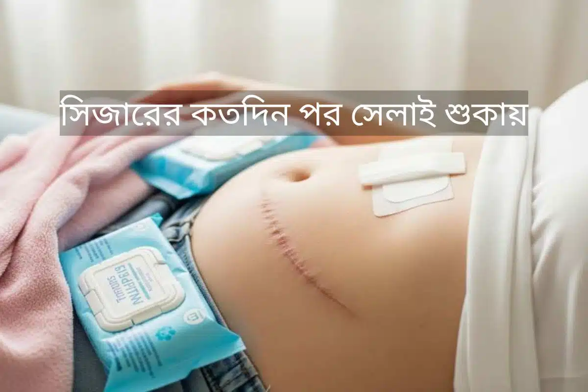 সিজারের কতদিন পর সেলাই শুকায় তা বোঝাতে নিরাময় হওয়া সিজারিয়ান দাগ এবং যত্নের প্রতীকী চিত্র রয়েছে।